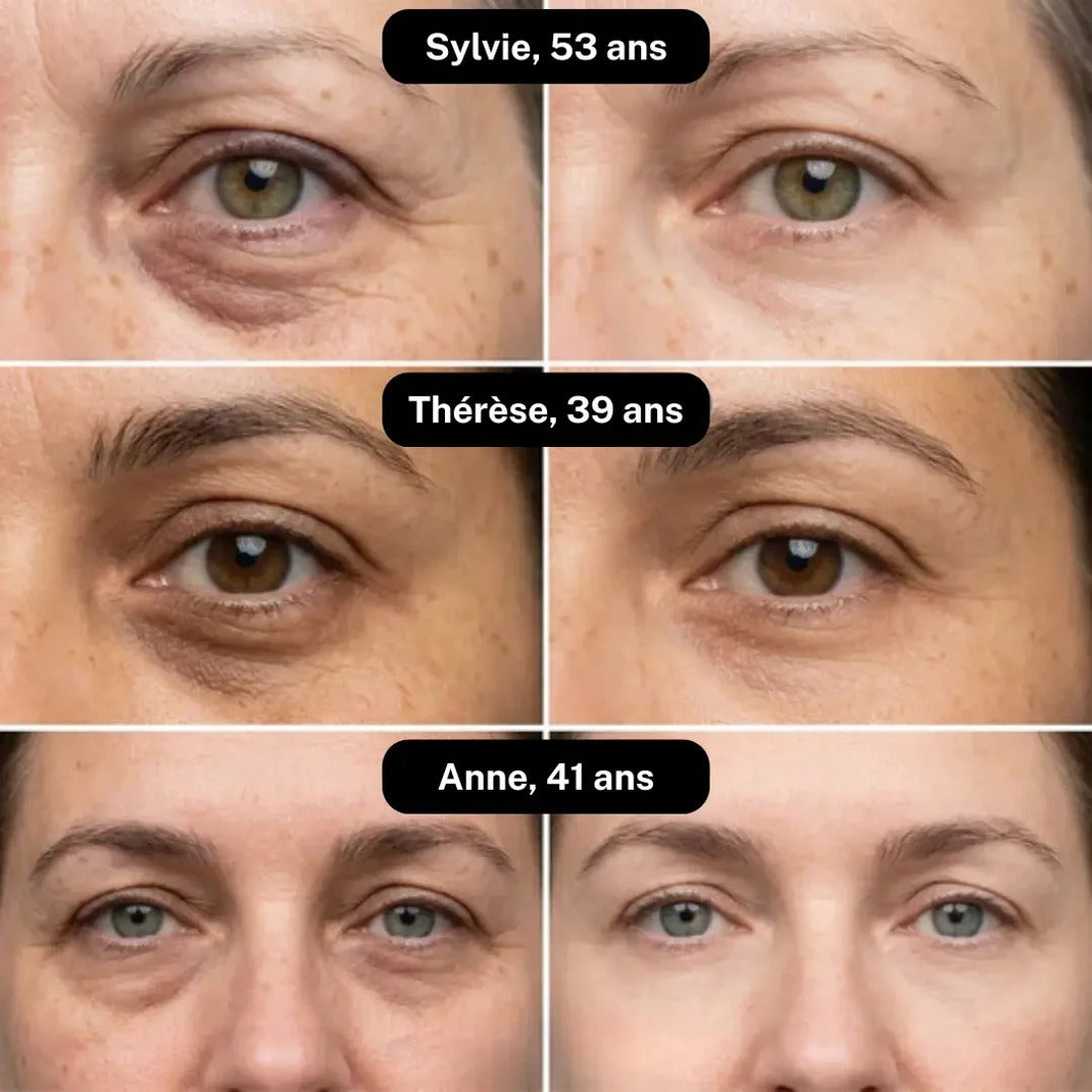 ALOEVE™ | Patchs Hydrogel Contour des Yeux à l’Aloe Vera